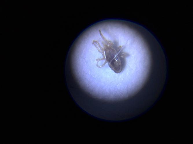 澳门管家婆100%精准天天和眼痒发现3虫在眼中与眼里痒是不是有虫